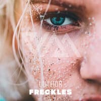 Freckles