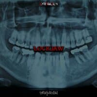 LOCKJAW